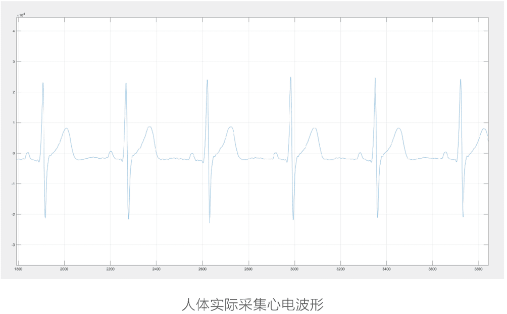 医疗级心电模块，为智能马桶增添健康守护力